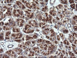 VTI1A Antibody (clone OTI1F4)