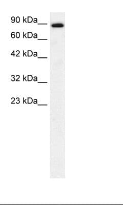 Polyclonal Rabbit anti-Human KIF21A Antibody (aa551-600, IHC, WB)