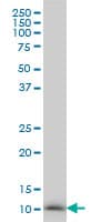 NDUFB3 Antibody (clone 6C6)