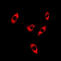 Polyclonal Rabbit anti-Human CFAP20 / GTL3 Antibody (IF, WB)