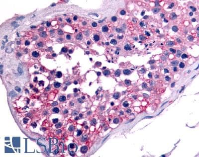 PathPlus™ Polyclonal Rabbit anti-Human NR6A1 / GCNF Antibody (Ligand-binding Domain, IHC)
