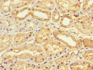 SEC22L2 / SEC22A Antibody