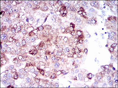 SLC27A5 / BACS Antibody (aa508-570, clone 4B11C10)