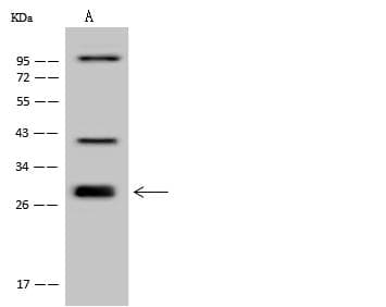 UBXD4 / UBXN2A Antibody
