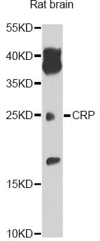 CRP / C-Reactive Protein Antibody