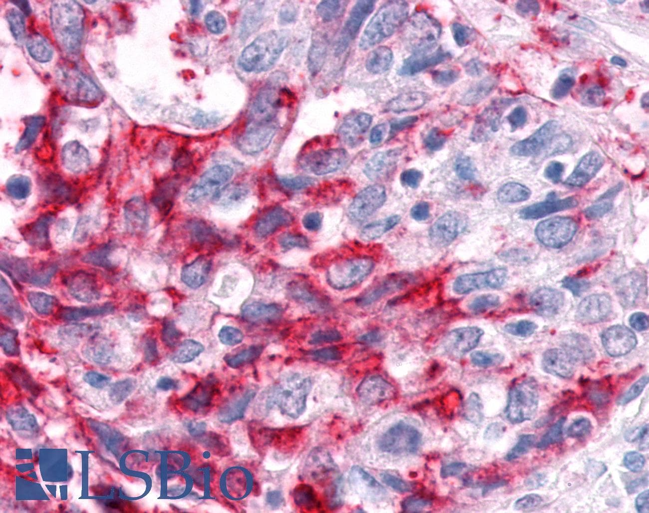 IHC-plus™ ESRRA / ERR Alpha Antibody (Ligand-binding Domain)