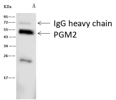 PGM2 Antibody