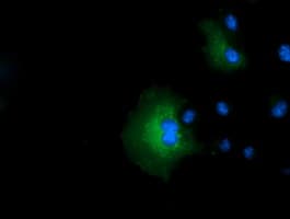 IVD Antibody (clone OTI5A11)