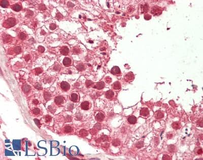 KAT5 / TIP60 Antibody (aa42-91)