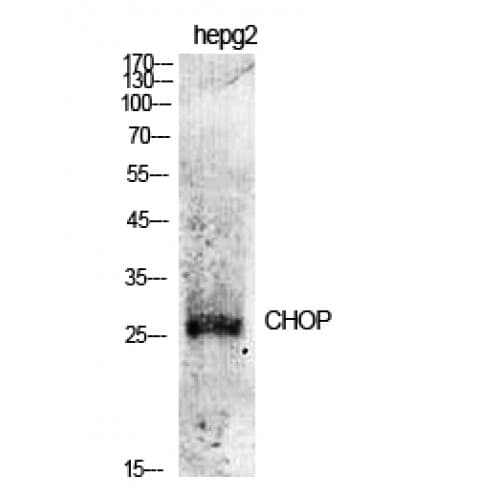 IHC-plus™ DDIT3 / CHOP Antibody (10-90 aa)