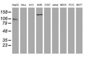 NNA1 / AGTPBP1 Antibody (clone OTI9D11)