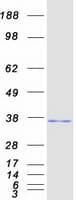 Human RASD2 Protein (Recombinant Myc-DDK (Flag))