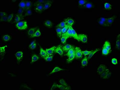 Polyclonal Rabbit anti-Human CAB39L Antibody (WB)