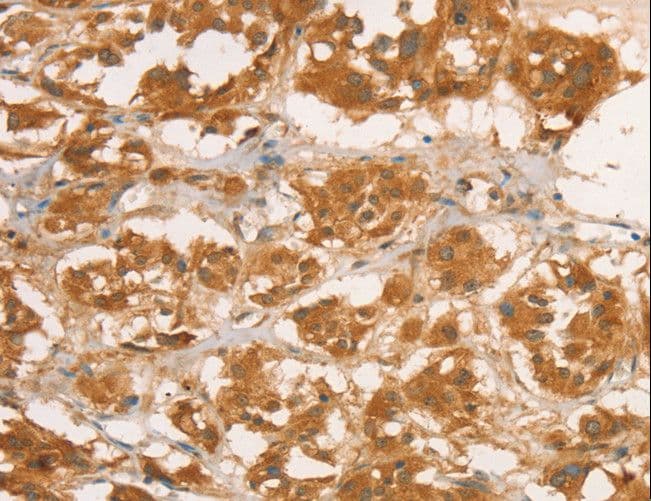 IHC-plus™ Polyclonal Rabbit anti-Human CPB / Carboxypeptidase B Antibody (IHC)