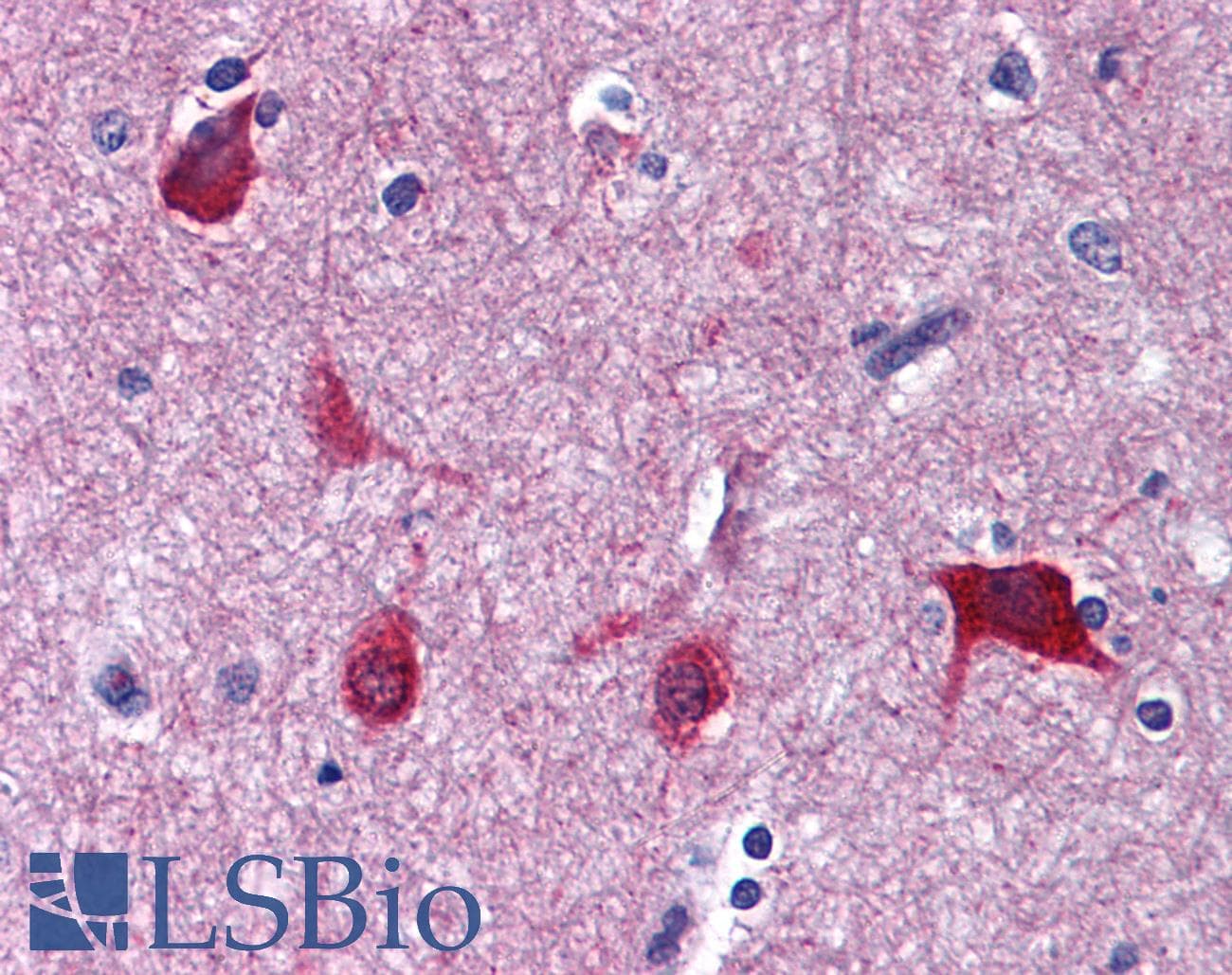 IHC-plus™ EEF1A2 Antibody