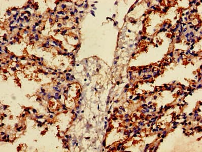 Polyclonal Rabbit anti-Human FFAR2 / GPR43 Antibody