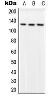 Polyclonal Rabbit anti-Human FAK / Focal Adhesion Kinase Antibody (phospho-Tyr576, WB)