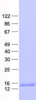 Human RPL30 / Ribosomal Protein L30 (Recombinant His, N-Terminal)
