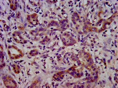 LSR / LISCH7 Antibody