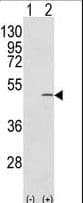 CAPZB / CAPZ Beta Antibody (aa229-257)