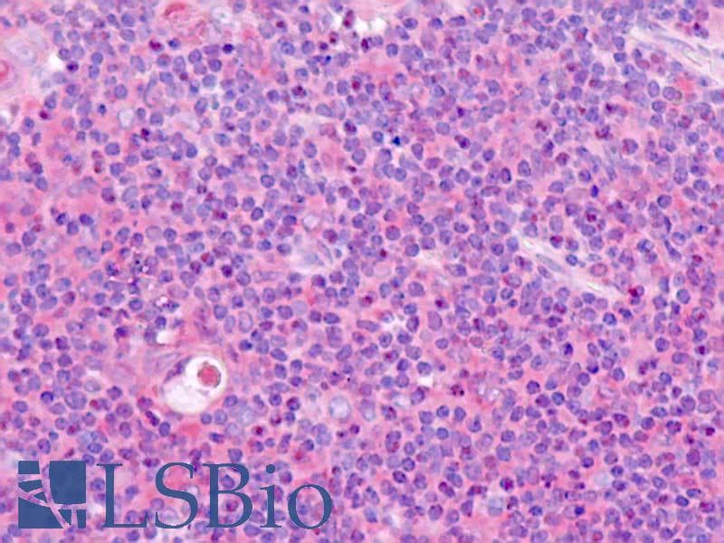 IHC-plus™ OLFML2B Antibody (aa171-220)