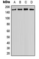 MYO3B Antibody (C-Terminus)