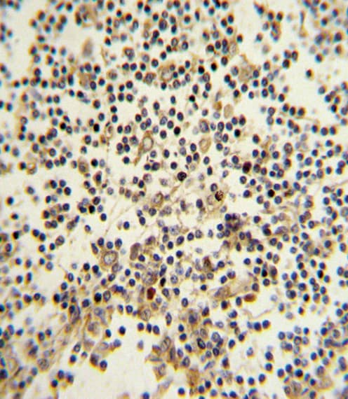 Polyclonal Rabbit anti-Human CD82 Antibody (aa239-267, IHC, WB)