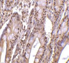PHAP III / ANP32E Antibody (C-Terminus)