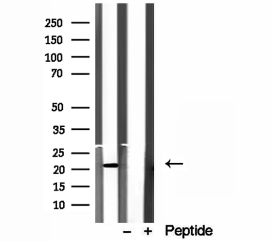 ICT1 / DS1 Antibody