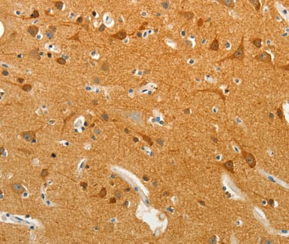Polyclonal Rabbit anti-Human SLC18A2 / VMAT2 Antibody (IHC, WB)