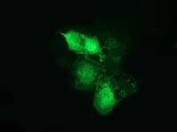 CTNNB1 / Beta Catenin Antibody (clone OTI12C1)