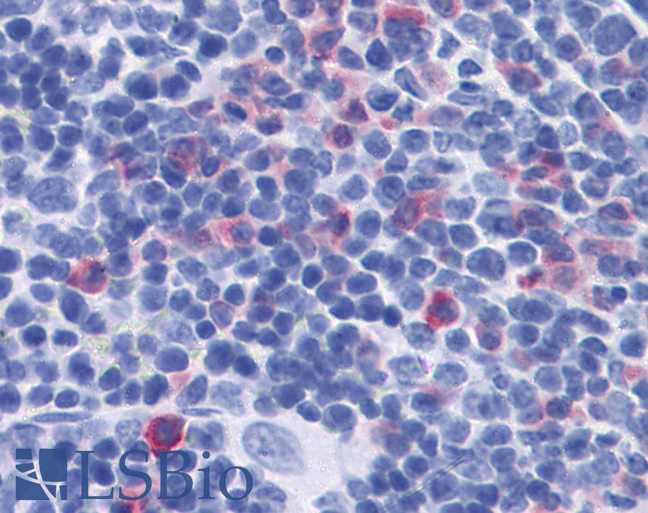 IHC-plus™ Monoclonal Rat anti-Mouse IL17 Antibody (clone TC11-18H10, IHC, WB)