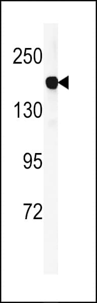 DGKK Antibody (aa1232-1261)