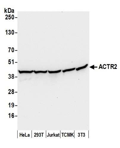ACTR2 / ARP2 Antibody (aa25-75)