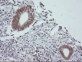 MAPK9 / JNK2 Antibody (clone OTI1A1)