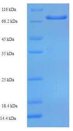 Human PH4 / P4HTM Protein (Recombinant His-SUMO)