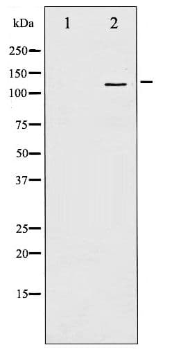 FAK / Focal Adhesion Kinase Antibody (phospho-Tyr397)