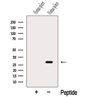 TIMM21 Antibody (aa63-83)