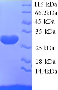 Human KCND2 / Kv4.2 Protein (Recombinant His)