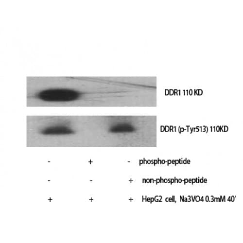 NEP / DDR1 Antibody (450-530 aa)