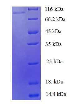 Human ZNF175 Protein (Recombinant His-SUMO)