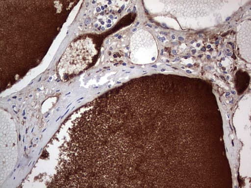 FCMR / FAIM3 Antibody (clone OTI1E6)