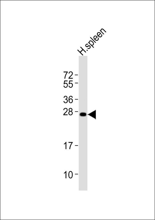 TNFAIP8 / SCC-S2 Antibody