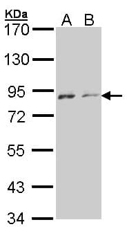 Polyclonal Rabbit anti-Human NEK4 Antibody (aa241-504, IHC, WB)