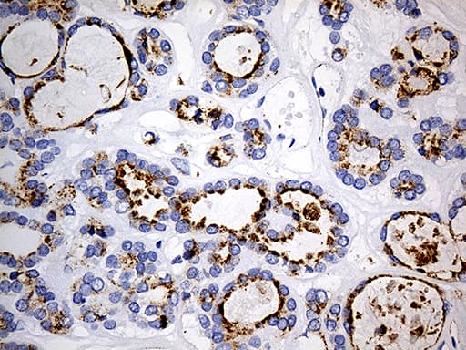 LAMP1 / CD107a Antibody (aa29-382, clone OTI8B1)