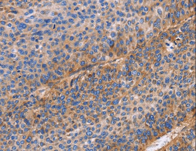 ITGB1 / Integrin Beta 1 / CD29 Antibody