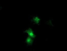SDS Antibody (clone OTI1H5)
