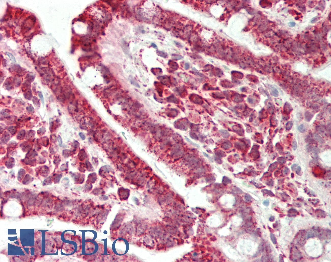 IHC-plus™ Polyclonal Rabbit anti-Human CD86 Antibody (IHC, IF, WB)
