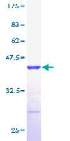 Human RPLP2 Protein (Recombinant GST)