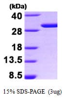 Human SFN / Stratifin / 14-3-3 Sigma Protein (Recombinant)